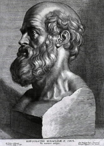 ヒポクラテスの彫刻