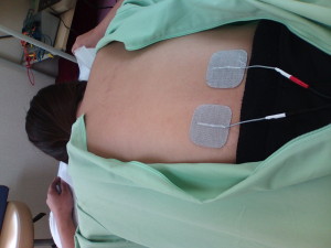 MCR（微弱電流）療法による腰の治療の写真