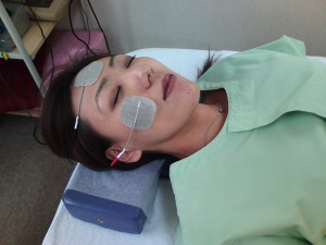 MCR（微弱電流）療法による顔の治療の写真