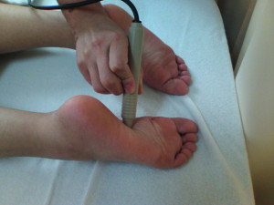 ソフトレーザー鍼治療器による足底の治療の写真